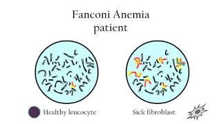 Fanconi Anemia  Genetic diagnosis [upl. by Eira]