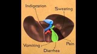 Sludge in Gallbladder Symptoms [upl. by Elyc]