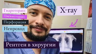 Xray in surgery Рентгенография в хирургии Научим видеть рентгенкартину в двух словах [upl. by Villada]