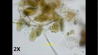 Pediastrum duplex  autocolony formation [upl. by Nemzaj417]