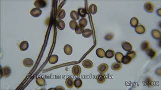 Toxic House Mold Under the Microscope [upl. by Ennaeilsel]