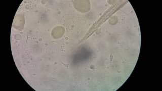 Filariform larva of Hookworms [upl. by Asiaj]