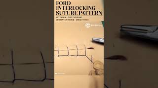 Ford Interlocking Suture Pattern Lock Stitch shorts medical suture suturing training [upl. by Anez489]