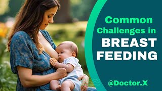 Common Challenges in Breastfeeding Overcoming Hurdles for New Moms [upl. by Niehaus]