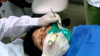 Uso de Lupa  Endodoncia [upl. by Aria]