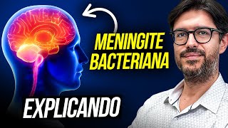 Meningite Bacteriana  O Que é Meningite Bacteriana [upl. by Wren]