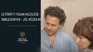 Letörött fogak kezelése  SmileCenter  Jól nézek ki [upl. by Annawad]