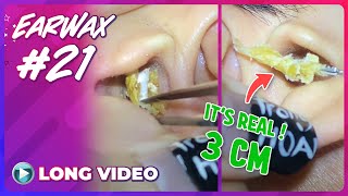 EP 21 Earwax ASMR Remove earwax to hear the world talk more clearly in full HD mode [upl. by Marella]