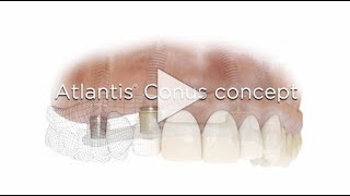 Atlantis Conus concept [upl. by Burack]