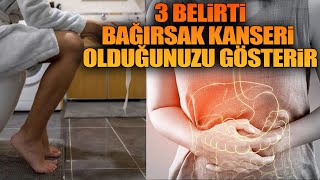 3 Belirti Bağırsak Kanseri Olduğunuzu Gösterir [upl. by Deacon730]