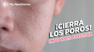 ¡CIERRA LOS POROS Info 100 Efectiva  Dermatólogo Responde [upl. by Kaycee962]