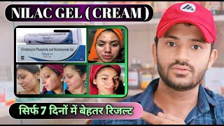 Nilac gel uses in hindi how to use nilac gel [upl. by Eveiveneg25]