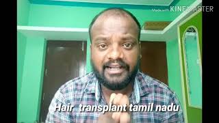 Hair transplant செய்வதற்கு முன்பு முடியை பாதுகாப்பது எப்படி [upl. by Joann]