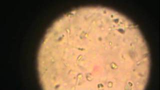 Observación de espermatozoides en microscopio óptico 1 [upl. by Swinton]