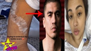 Bianca Jackes Shows Wound Caused By Former Live In Partner Mark Cardona Following Stabbing Incident [upl. by Nicolais116]