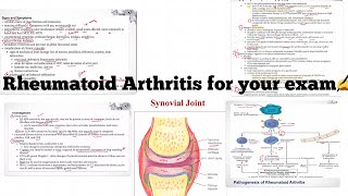 Rheumatoid arthritis for your exam make it easy [upl. by Prudie143]