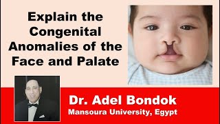 Explain the Congenital Anomalies of the Face and Palate Dr Adel Bondok [upl. by Leuams]