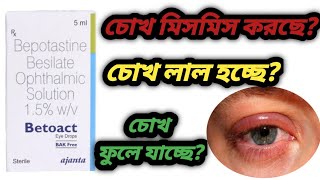 Betoact eye drops benefits use in bengali review চোখ লাল হওয়া সমস্যা সমাধান করে। [upl. by Adnilreh458]