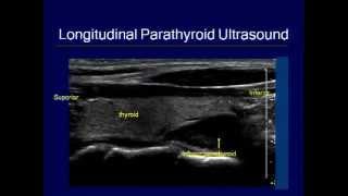 ATA Fellows Track 2012 Thyroid Ultrasound Course [upl. by Naujuj]