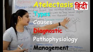 Atelectasis in Hindi  Types  Causes  Diagnostic Evaluation  Pathophysiology  Management [upl. by Alleira]