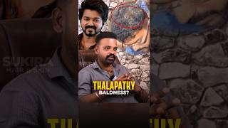 Actor Vijay Hair Transplant History  Sukira Aesthetic shorts hair hairtransformation vijay [upl. by Peyter293]