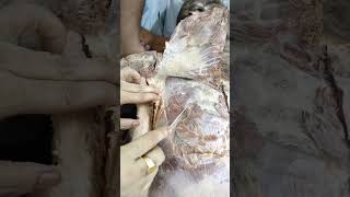 Dissection of Pectoral region [upl. by Mintun388]