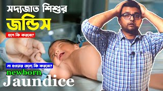 নবজাত শিশুর জন্ডিস  Newborn Jaundice  গুরুত্বপূর্ণ টিপস  Neonatal Jaundice  How to stop [upl. by Jasmine366]