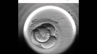 Embryoscope 1  Nuevo método de cultivo y selección embrionaria [upl. by Eleda481]