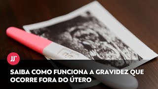 Gravidez fora do útero tem sintomas semelhantes à gestação normal saiba o tratamento [upl. by Salita]