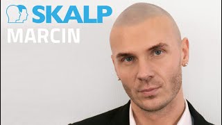 Baldness solution  Marcin explains Scalp Micropigmentation at Skalp® [upl. by Enilrac455]