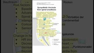 Sympathetic blockade from spinal anesthesia [upl. by Lareena]