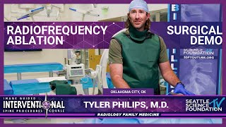 Radiofrequency Ablation Tyler Phillips MD [upl. by Woothen120]