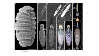 Dinoflagellates  Nematocysts [upl. by Adriena]