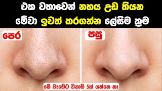 Easy Ways to Remove Blackheads and Whiteheads [upl. by Lyell873]