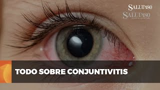 ✅ Todo sobre la conjuntivitis  Salud180 🌿 [upl. by Liahus412]