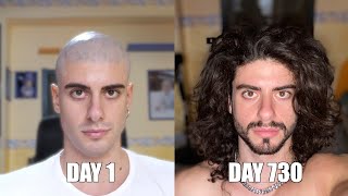 Two years time lapse of hair growth [upl. by Daryl]