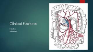 Ischemic Enteritis [upl. by Brader748]