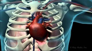 Coronary Heart Disease Animation [upl. by Riatsila361]