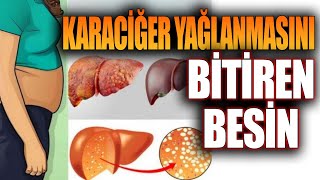 Karaciğer Yağlanmasını Bitiren Besin [upl. by Idaline]