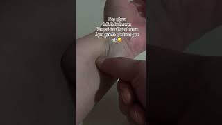 Refleksoloji başağrısı migren tedavi eğitim refleksoloji eğitimi masaji reflexology eğitim [upl. by Dulcy]