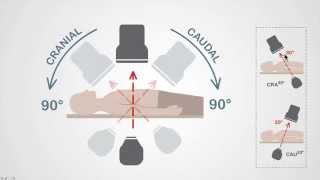 Mastering Coronary Angiography Image Intensifier amp Carm Fundamentals [upl. by Rawde]