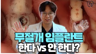 현직 치과의사 피셜 나라면 무절개 임플란트 한다 vs 안한다 [upl. by Aicatsan994]