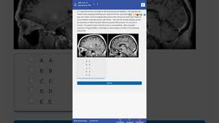 UWorld Questions uworld usmle plab AMC [upl. by Ariaz194]