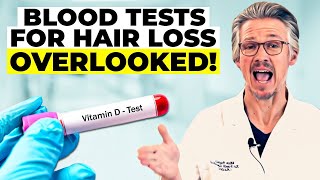 BLOOD TESTS FOR HAIR LOSS THE CRITICAL BLOOD TESTS YOU NEED NOW [upl. by Ferneau]