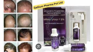 Minoxytop F5 Topical Solution Minoxidil amp Finasteride opical Sotution [upl. by Nna]