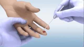 DPP® HIV 12 Assay  Whole Blood Sample [upl. by Iaw119]