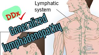 Approach to Diagnosing Generalized Lymphadenopathy [upl. by Eibbob]