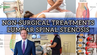 NonSurgical Treatment For Lumbar Spinal Stenosis Part 1 [upl. by Bedell287]