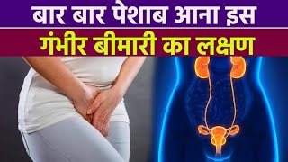 I Tried 10 Home Remedies for Frequent Urination and You Wont Believe What Happened [upl. by Jacqueline184]