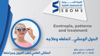 Exotropia patterns and treatment  الحول الوحشي انماطه وعلاجه [upl. by Stalder]